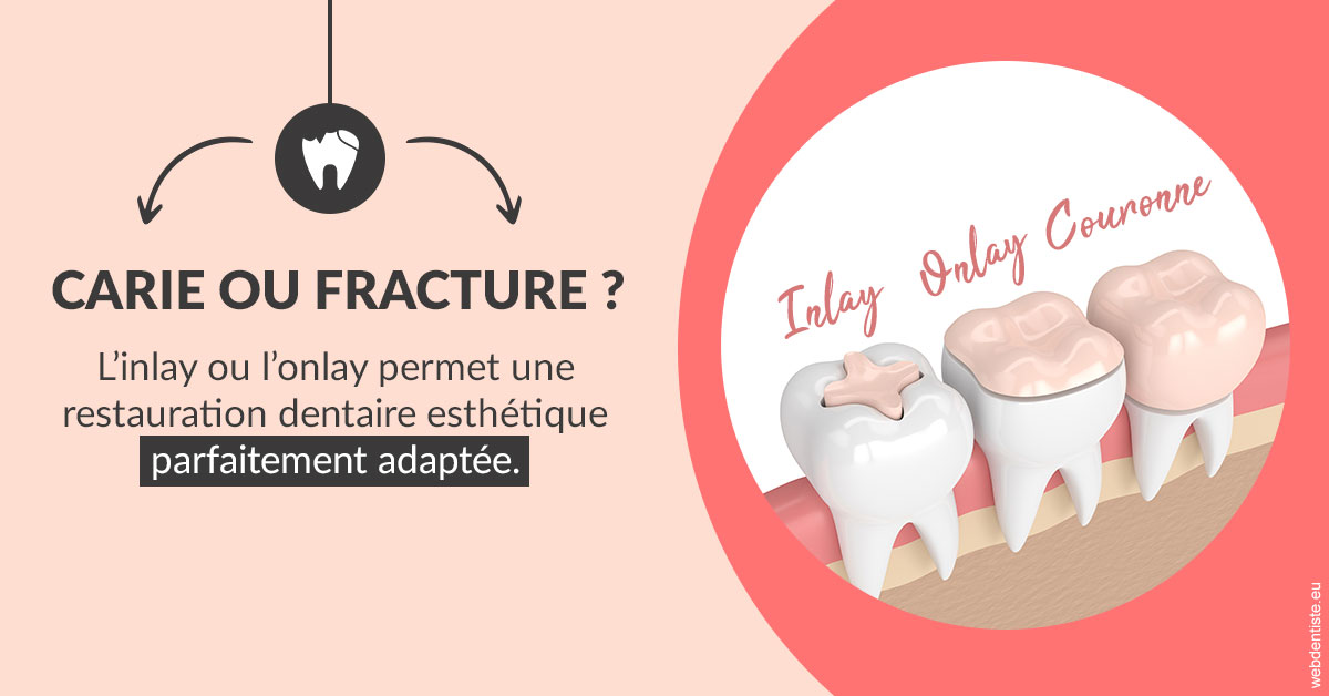 https://selarl-souffle-d-art-dentaire.chirurgiens-dentistes.fr/T2 2023 - Carie ou fracture 2