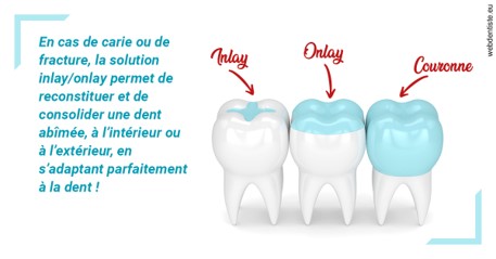 https://selarl-souffle-d-art-dentaire.chirurgiens-dentistes.fr/L'INLAY ou l'ONLAY