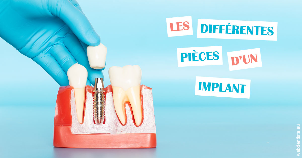 https://selarl-souffle-d-art-dentaire.chirurgiens-dentistes.fr/Les différentes pièces d’un implant 2