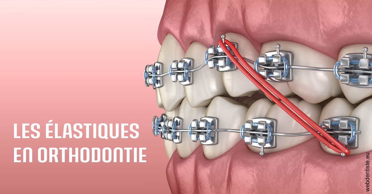 https://selarl-souffle-d-art-dentaire.chirurgiens-dentistes.fr/Elastiques orthodontie 2