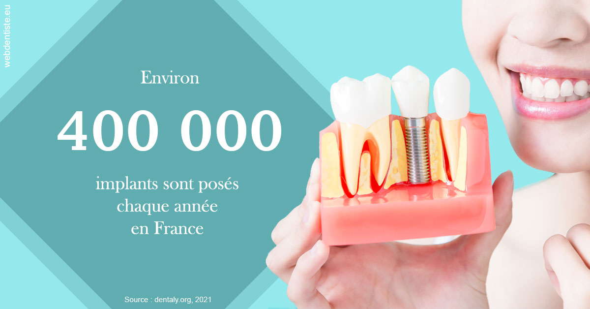 https://selarl-souffle-d-art-dentaire.chirurgiens-dentistes.fr/Pose d'implants en France 2
